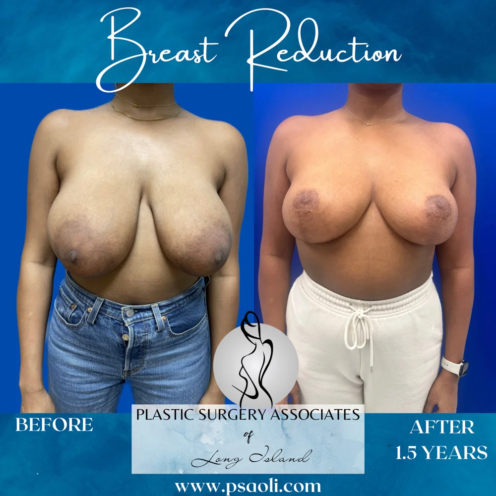 Blue Aqua Minimalist Sea Soothes the Soul Quote Instagram Post – 1