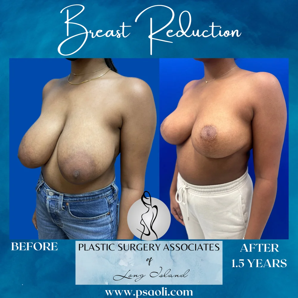 Blue Aqua Minimalist Sea Soothes the Soul Quote Instagram Post – 3