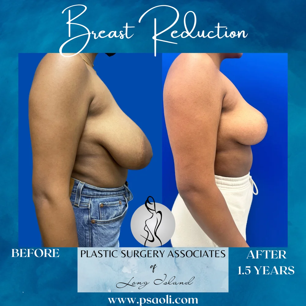 Blue Aqua Minimalist Sea Soothes the Soul Quote Instagram Post – 4