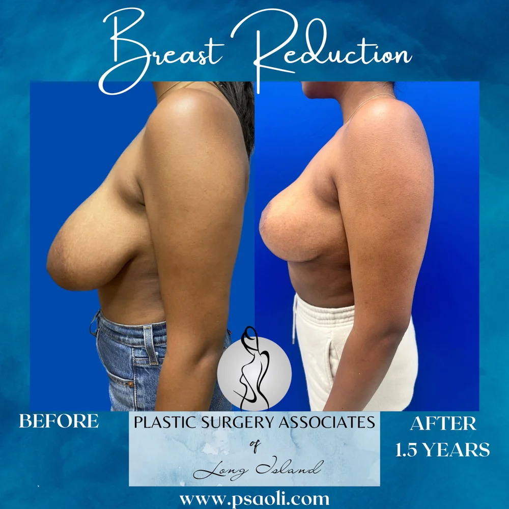 Blue Aqua Minimalist Sea Soothes the Soul Quote Instagram Post – 5