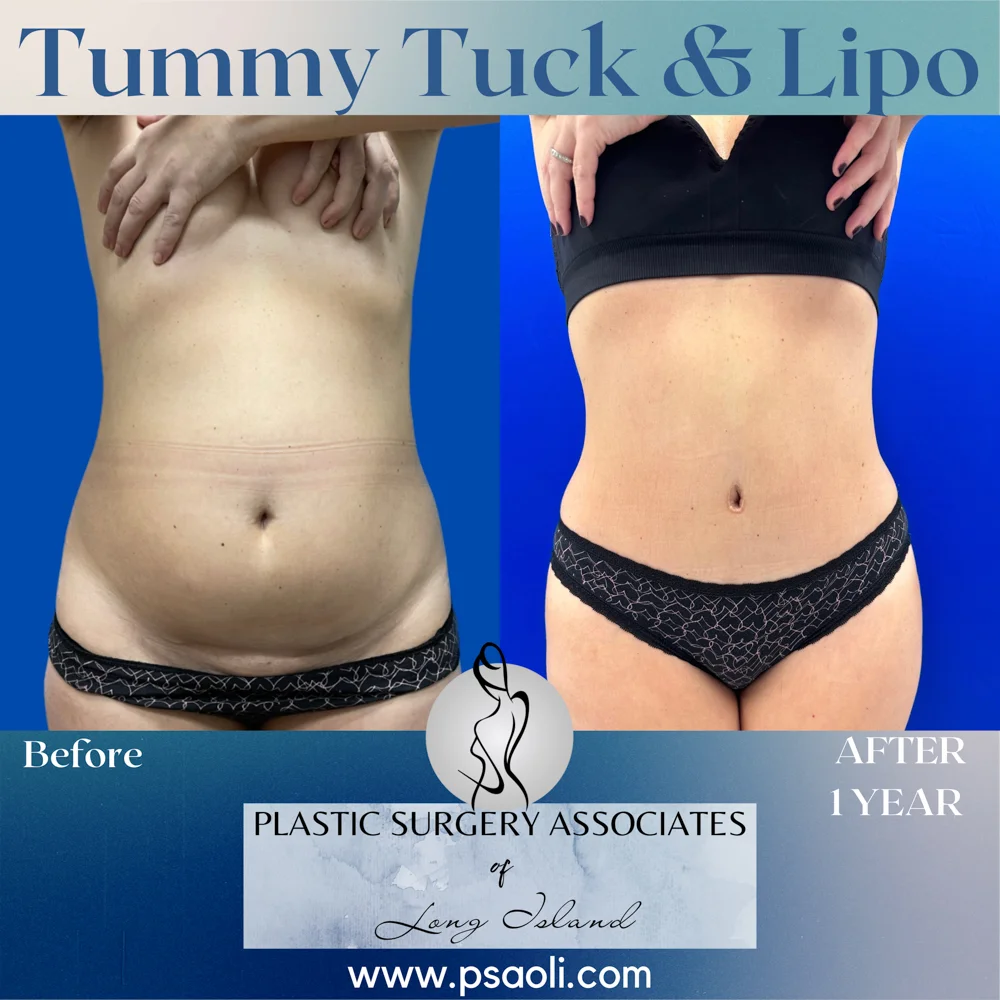 Blue Gradient Minimalist Thank You Greeting Card Instagram Post – 1