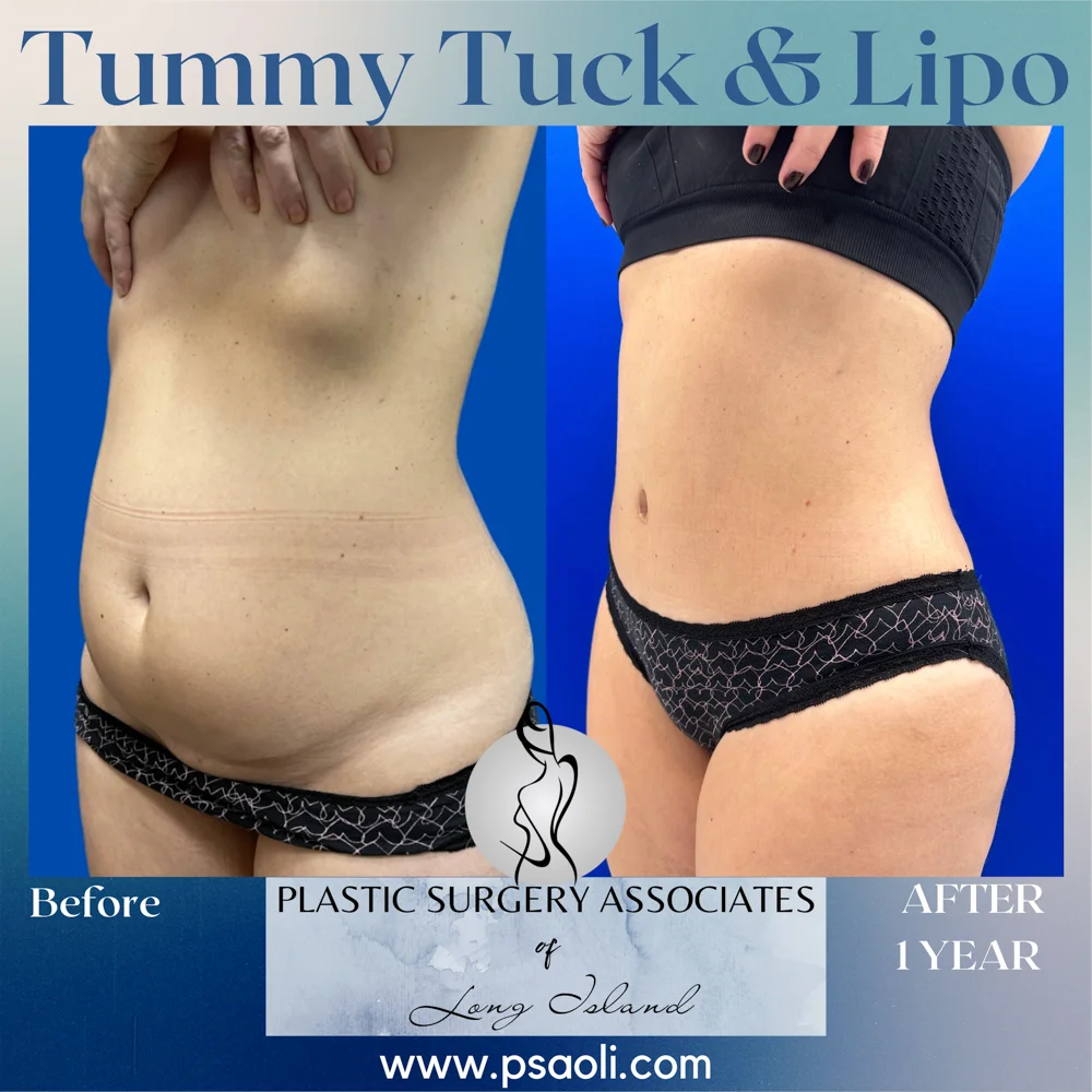 Blue Gradient Minimalist Thank You Greeting Card Instagram Post – 10