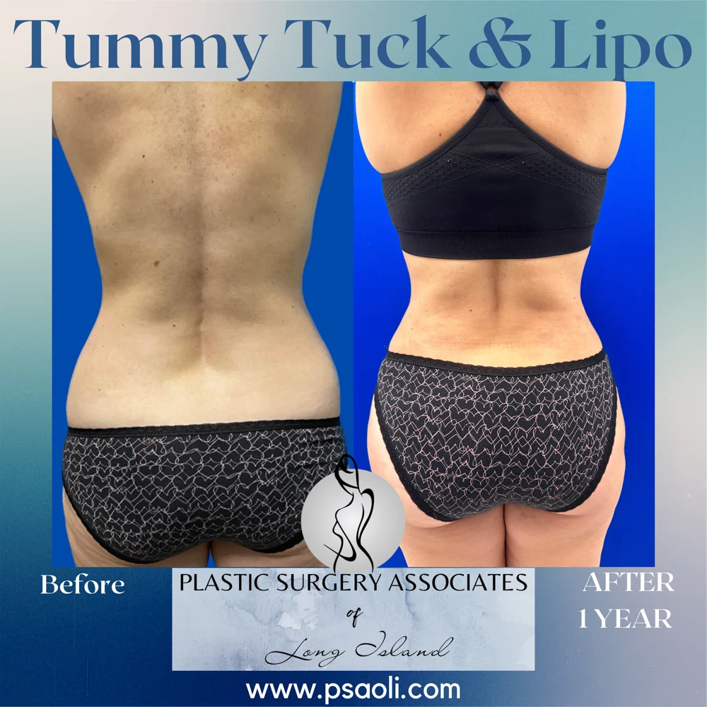 Blue Gradient Minimalist Thank You Greeting Card Instagram Post – 2