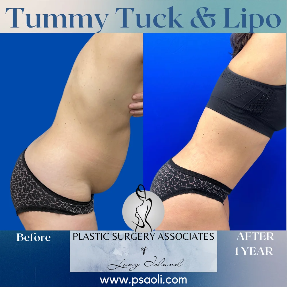 Blue Gradient Minimalist Thank You Greeting Card Instagram Post – 3