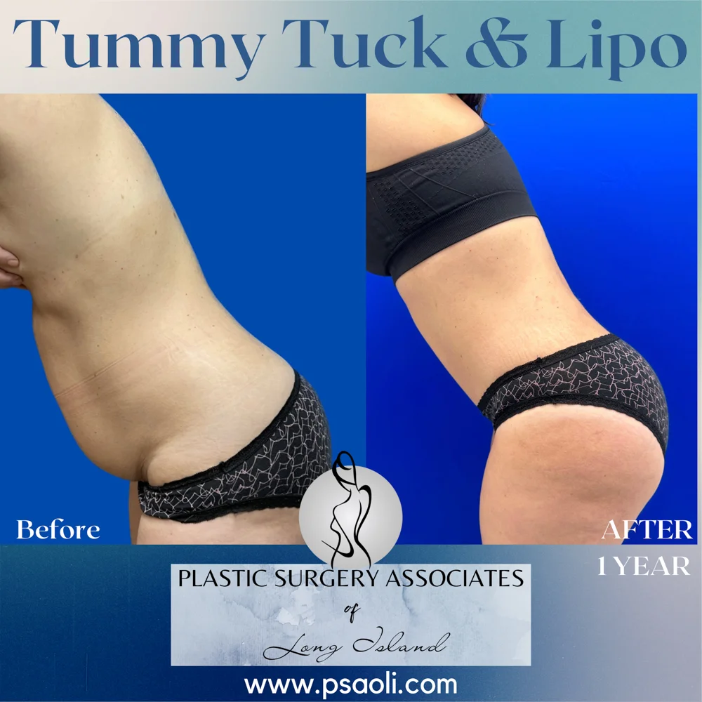 Blue Gradient Minimalist Thank You Greeting Card Instagram Post – 4