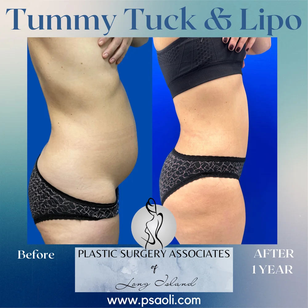 Blue Gradient Minimalist Thank You Greeting Card Instagram Post – 5