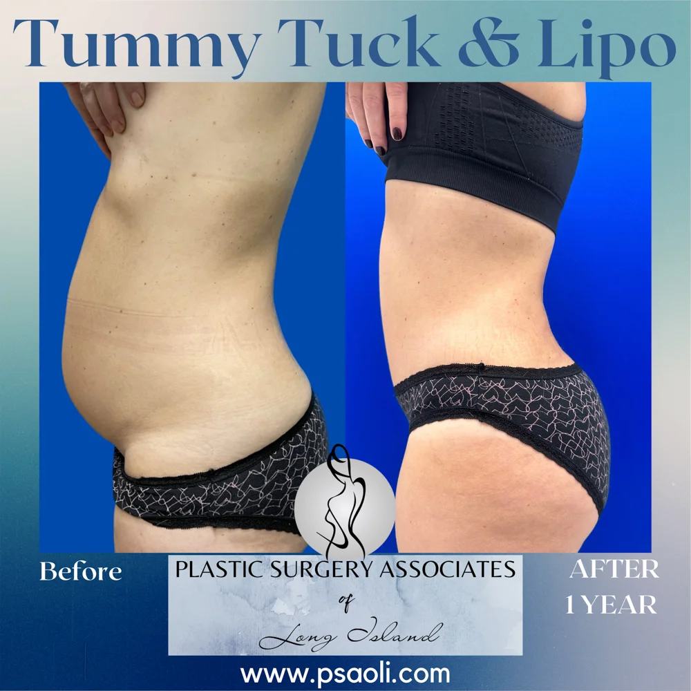 Blue Gradient Minimalist Thank You Greeting Card Instagram Post – 6