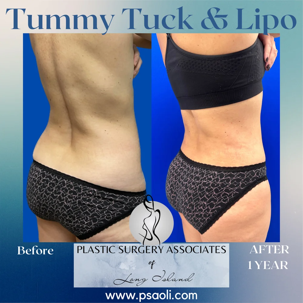 Blue Gradient Minimalist Thank You Greeting Card Instagram Post – 7