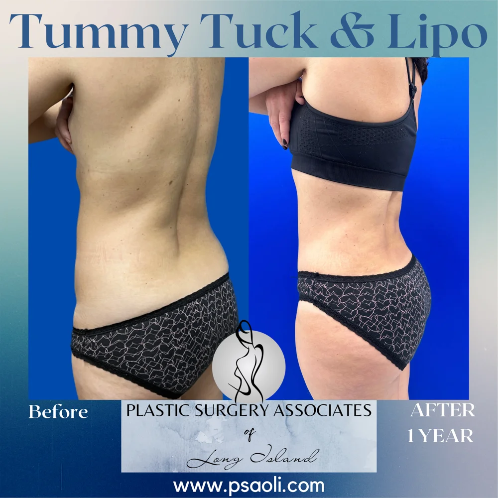 Blue Gradient Minimalist Thank You Greeting Card Instagram Post – 8