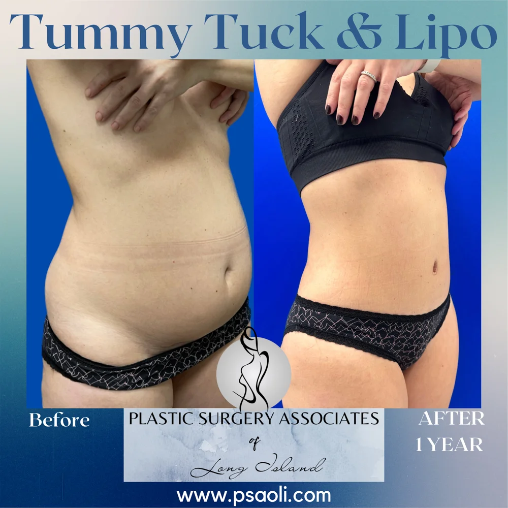 Blue Gradient Minimalist Thank You Greeting Card Instagram Post – 9