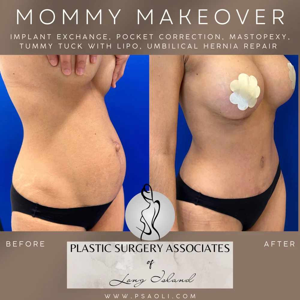 Brown Elegant Fashion New Collection Instagram Post – 4