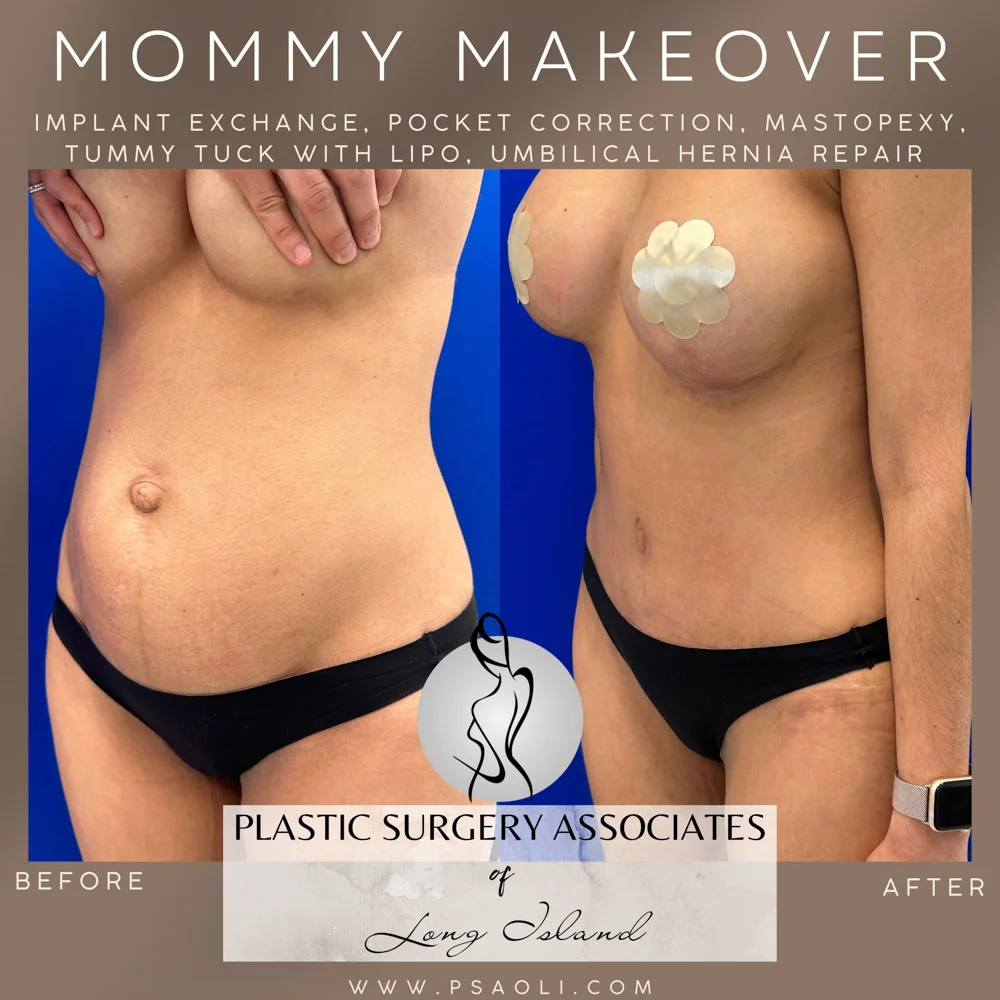 Brown Elegant Fashion New Collection Instagram Post – 5