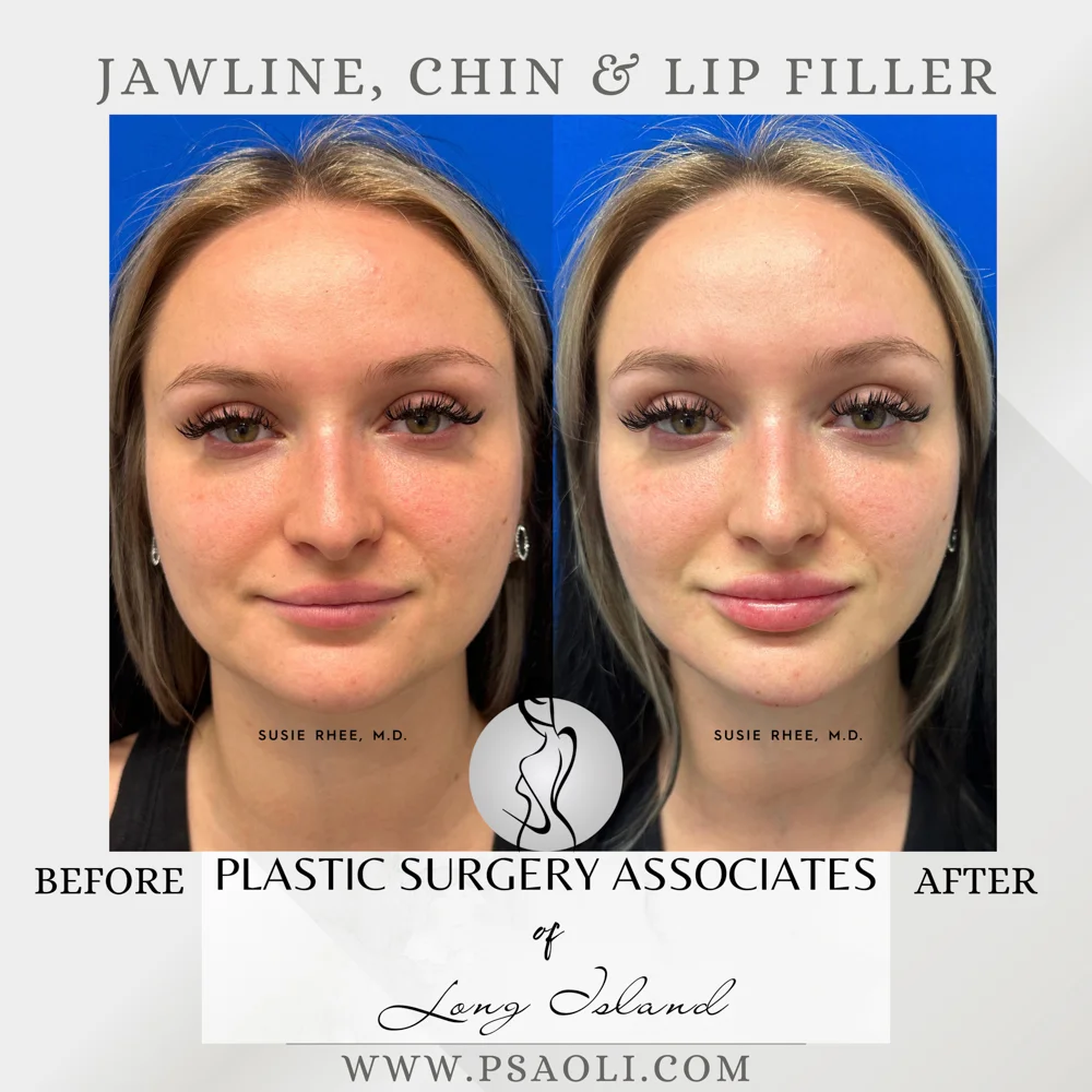 Copy of Grey Aesthetic Reminder Instagram Post – 1