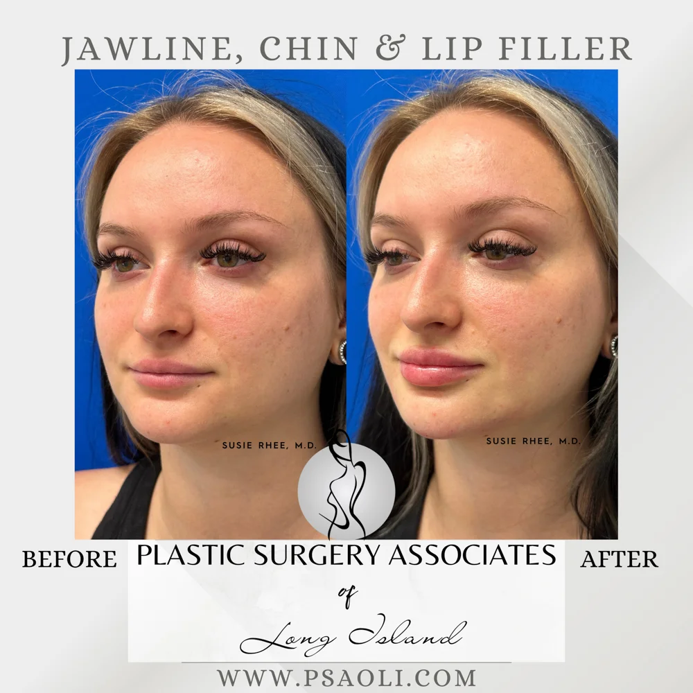 Copy of Grey Aesthetic Reminder Instagram Post – 2