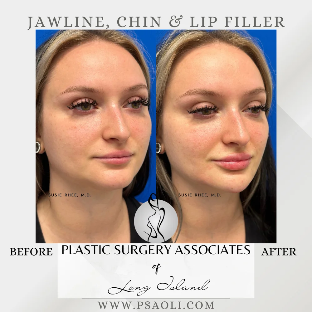 Copy of Grey Aesthetic Reminder Instagram Post – 3