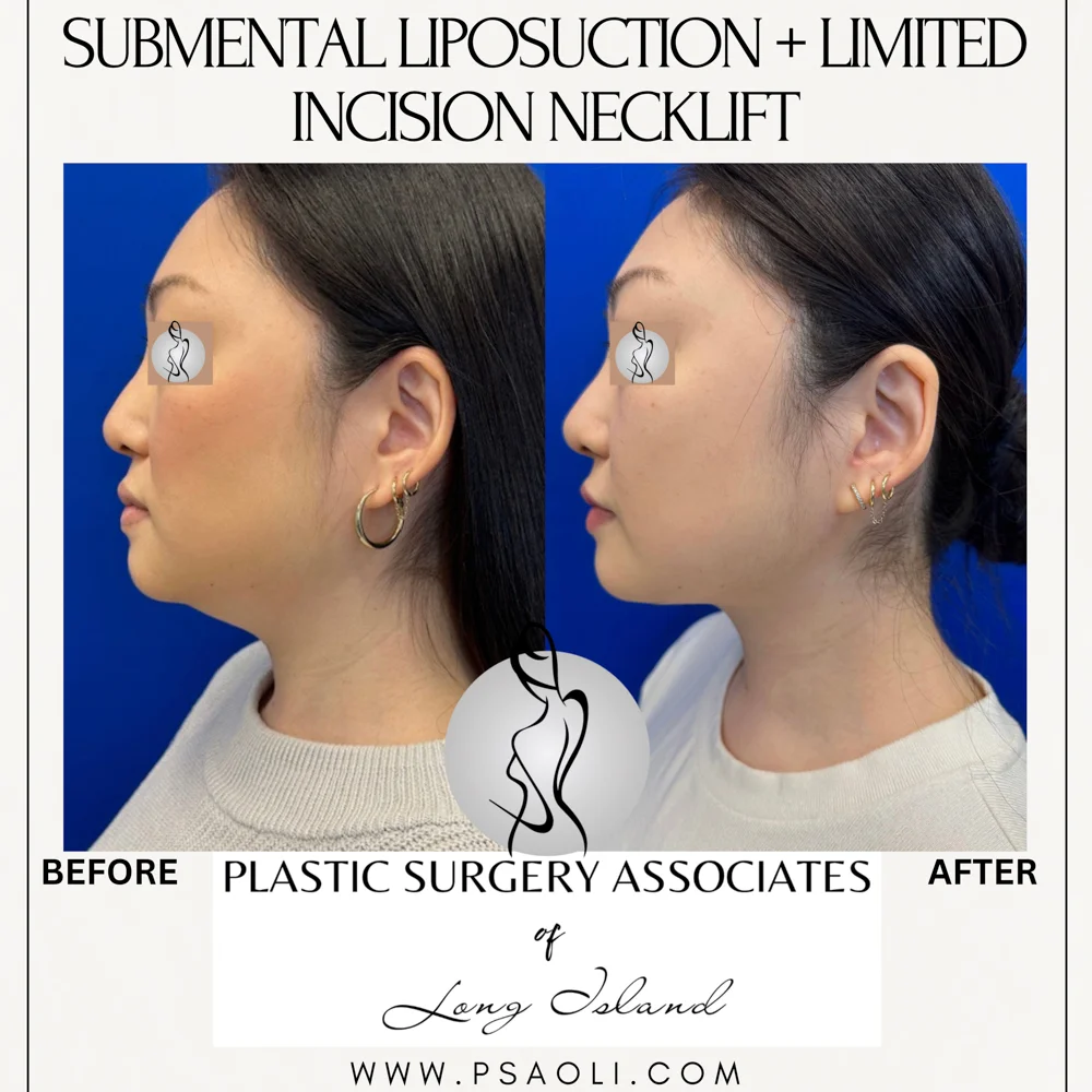 Cream Minimalist Elegant Quote Instagram Post – 1