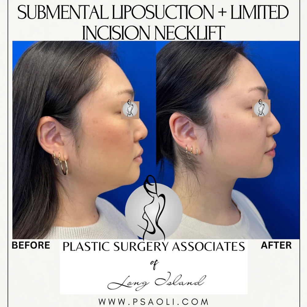 Cream Minimalist Elegant Quote Instagram Post – 2