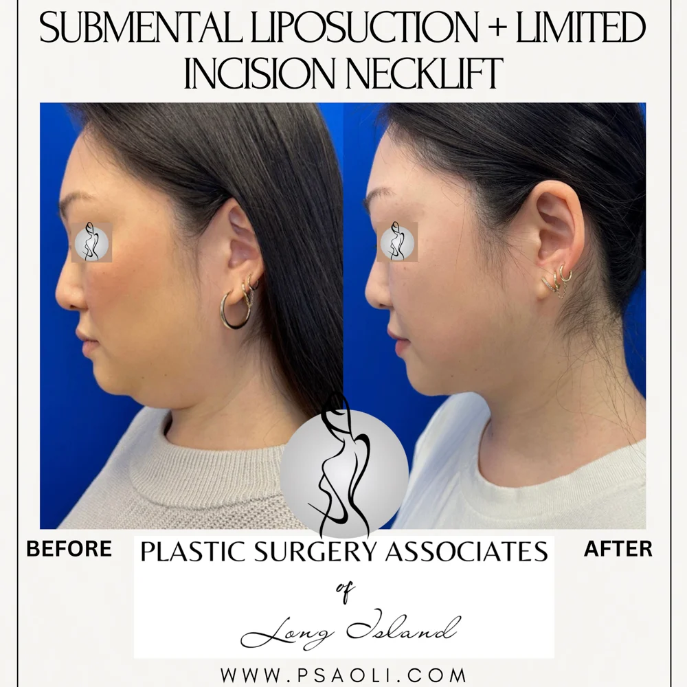 Cream Minimalist Elegant Quote Instagram Post – 3