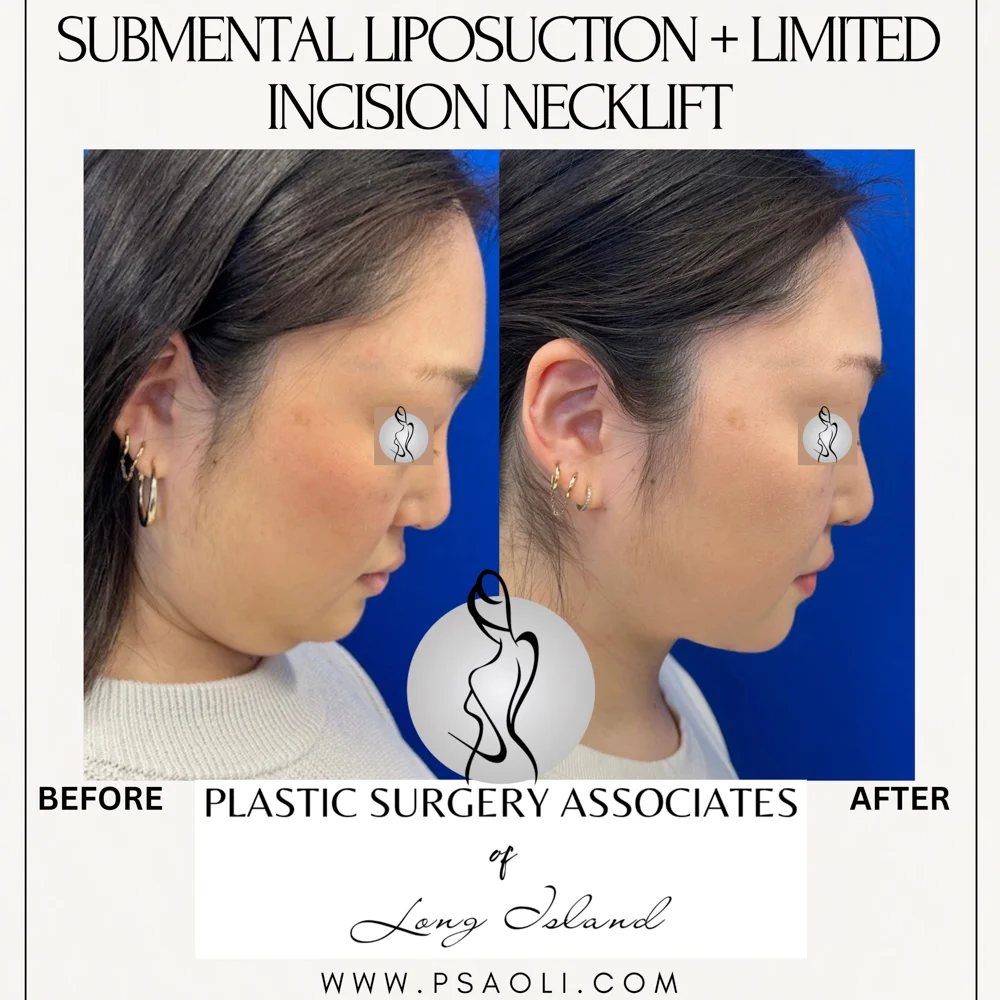 Cream Minimalist Elegant Quote Instagram Post – 4