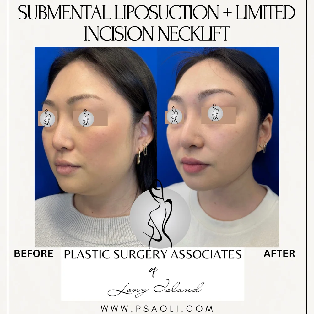 Cream Minimalist Elegant Quote Instagram Post – 5