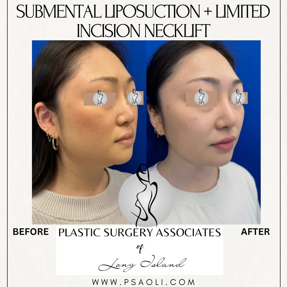 Cream Minimalist Elegant Quote Instagram Post – 6