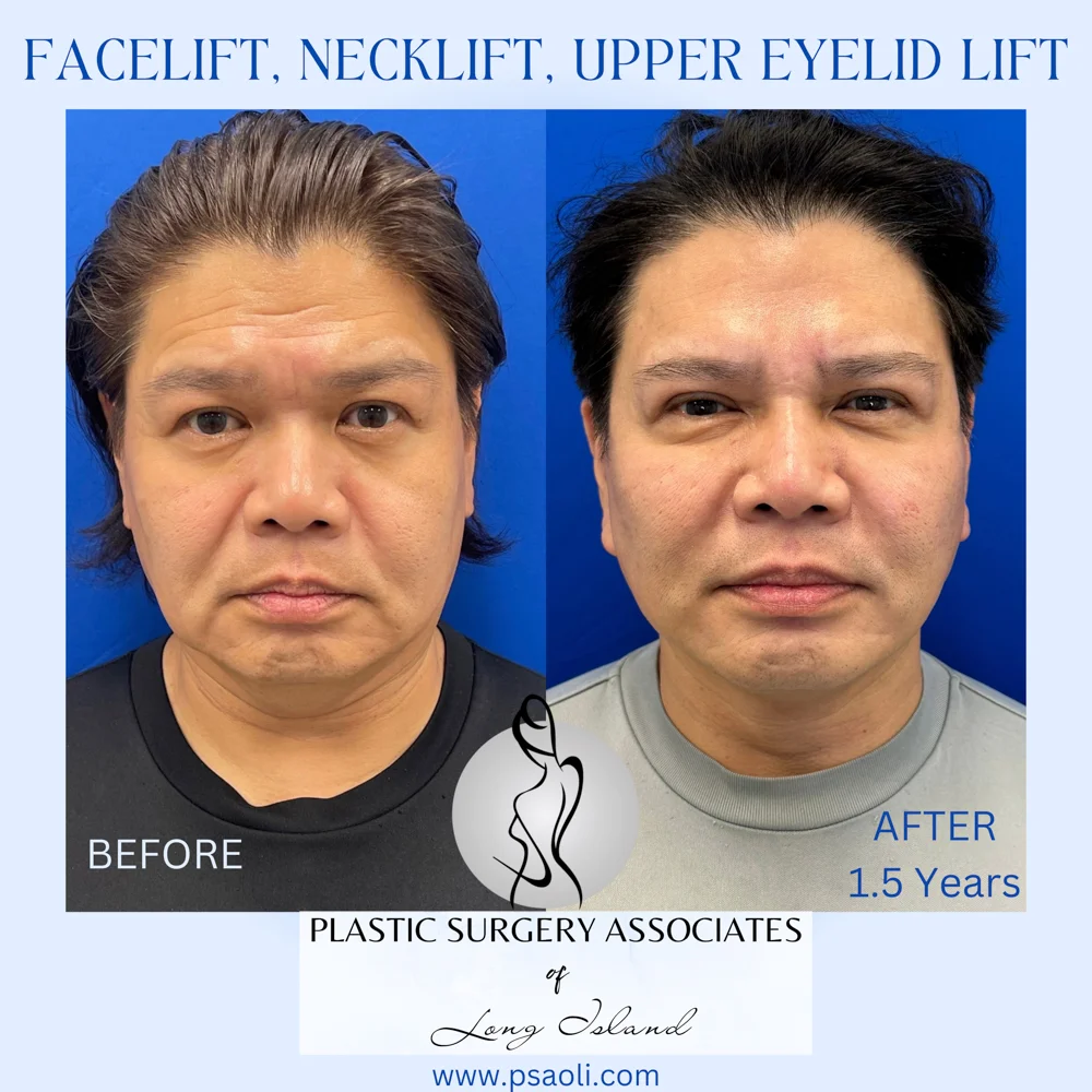 Cyan Blur Gradient Quote – 1