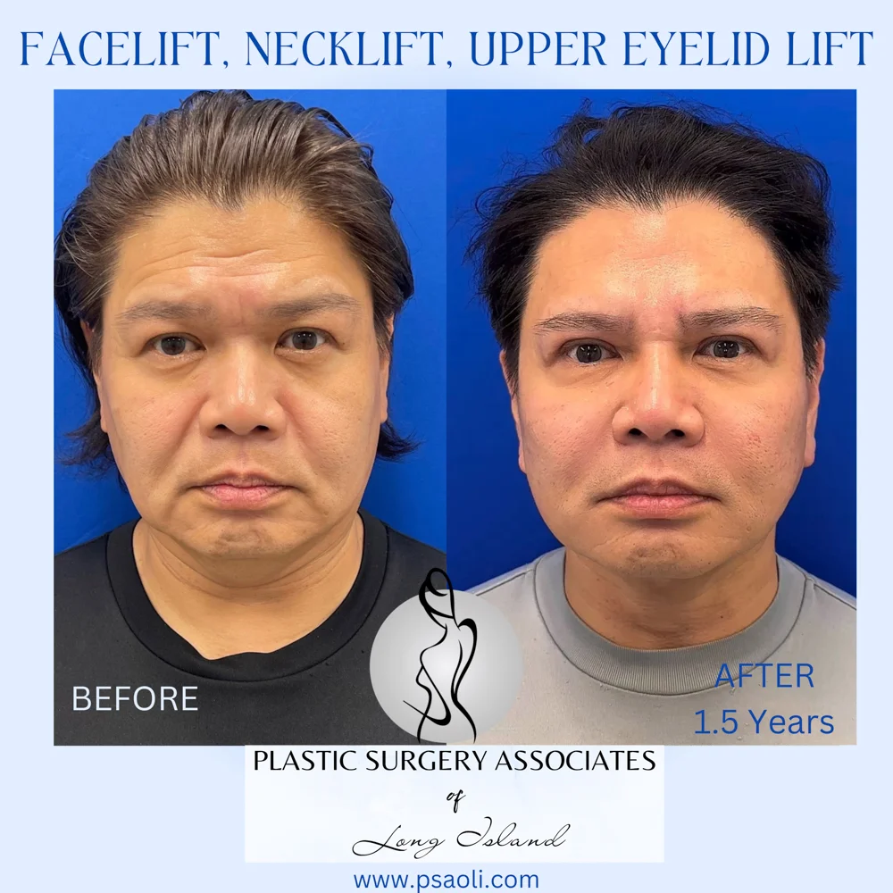 Cyan Blur Gradient Quote – 2