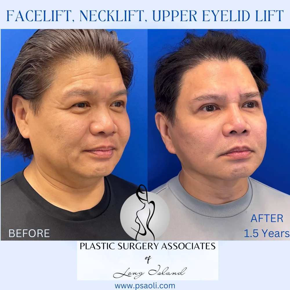 Cyan Blur Gradient Quote – 4