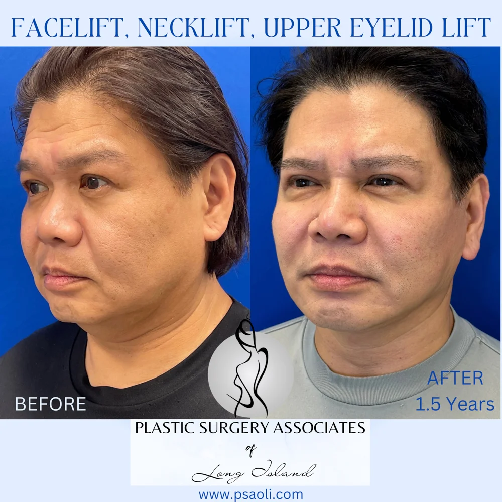 Cyan Blur Gradient Quote – 6