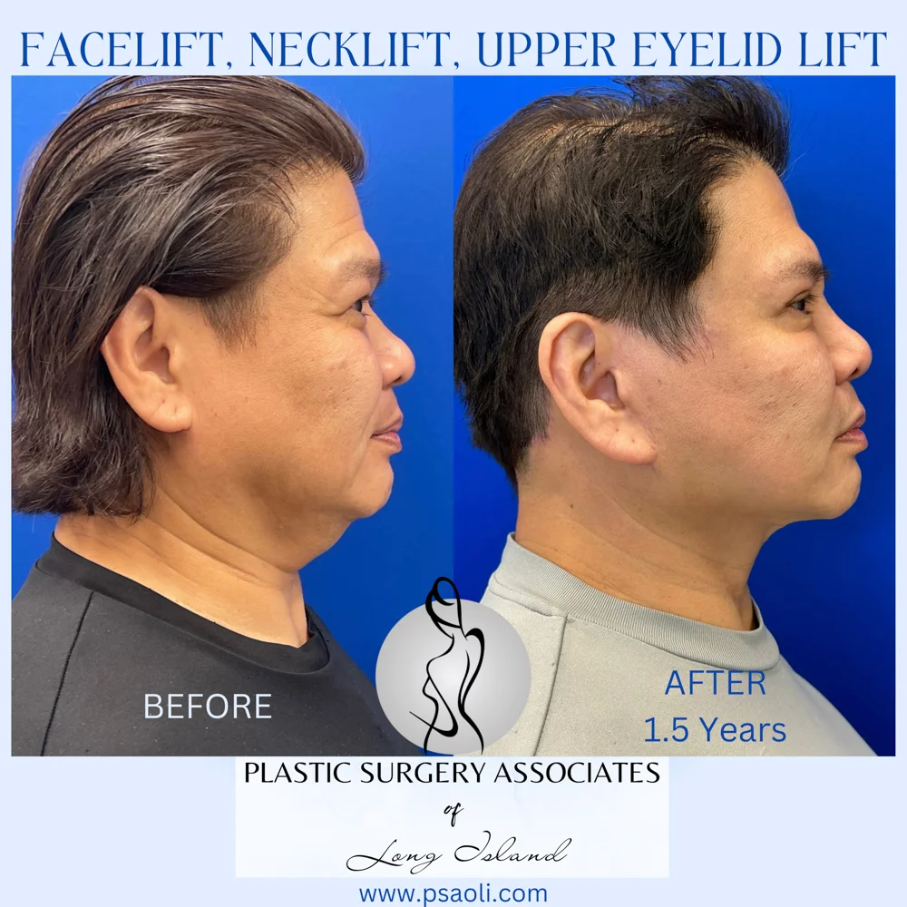 Cyan Blur Gradient Quote – 7