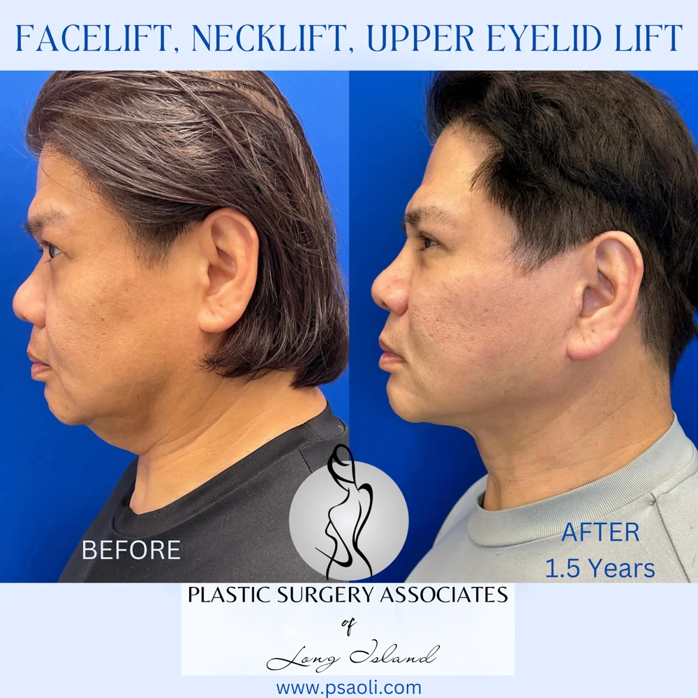 Cyan Blur Gradient Quote – 8