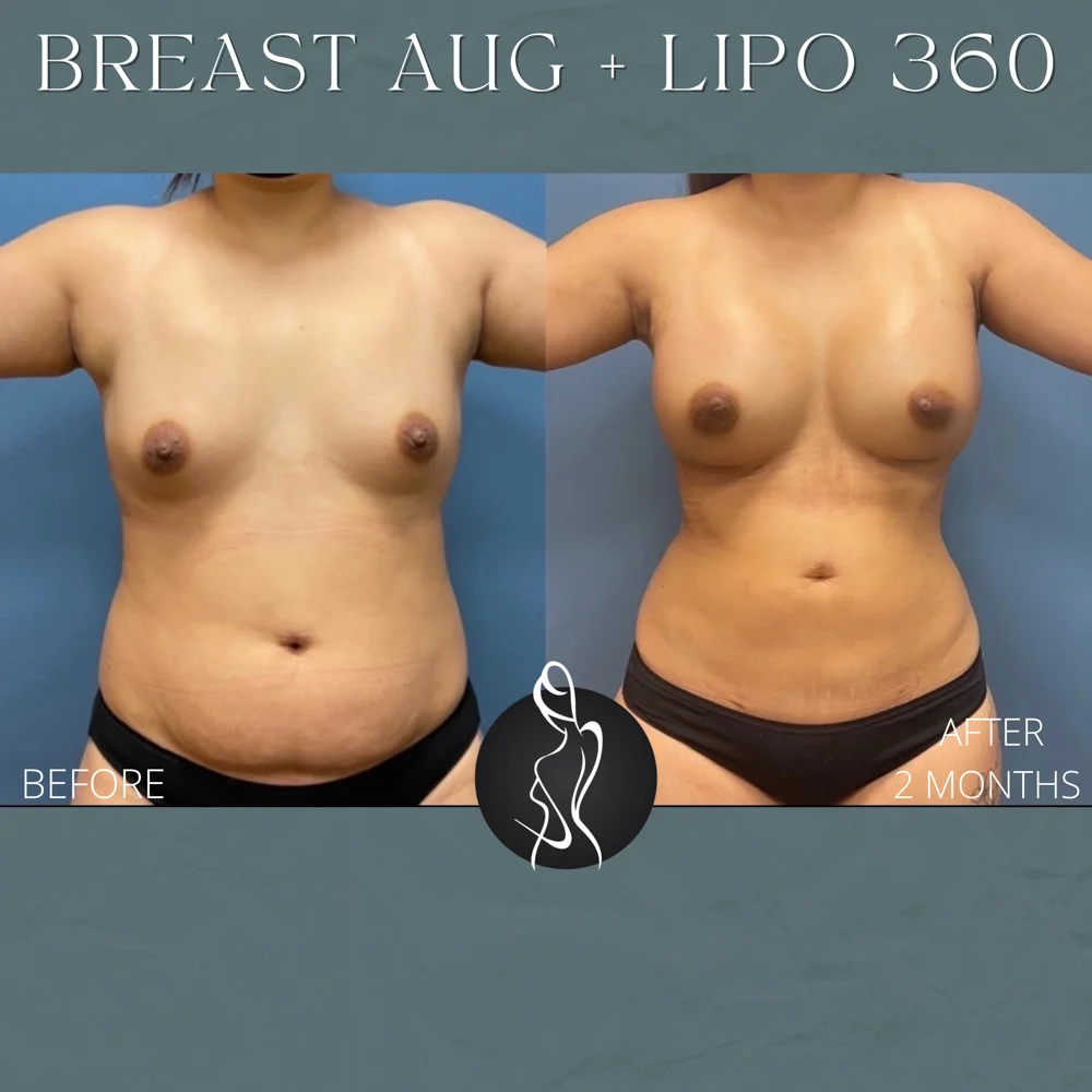 Green Simple Elegant Cosmetics New Formula Instagram Post