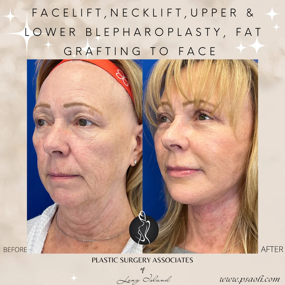 Neutral Delicate Magical Inspiring Reminder Animated Quote Instagram Post – 2