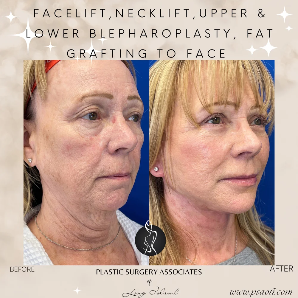 Neutral Delicate Magical Inspiring Reminder Animated Quote Instagram Post – 3