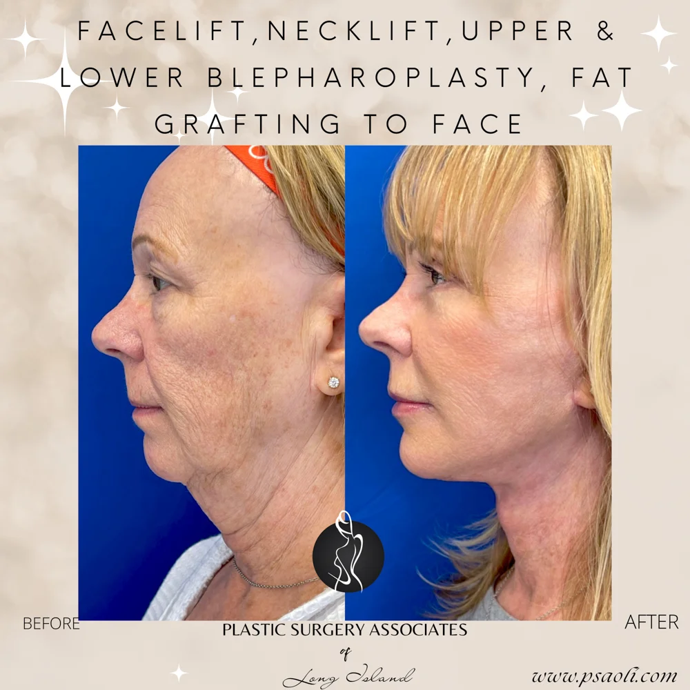 Neutral Delicate Magical Inspiring Reminder Animated Quote Instagram Post – 4