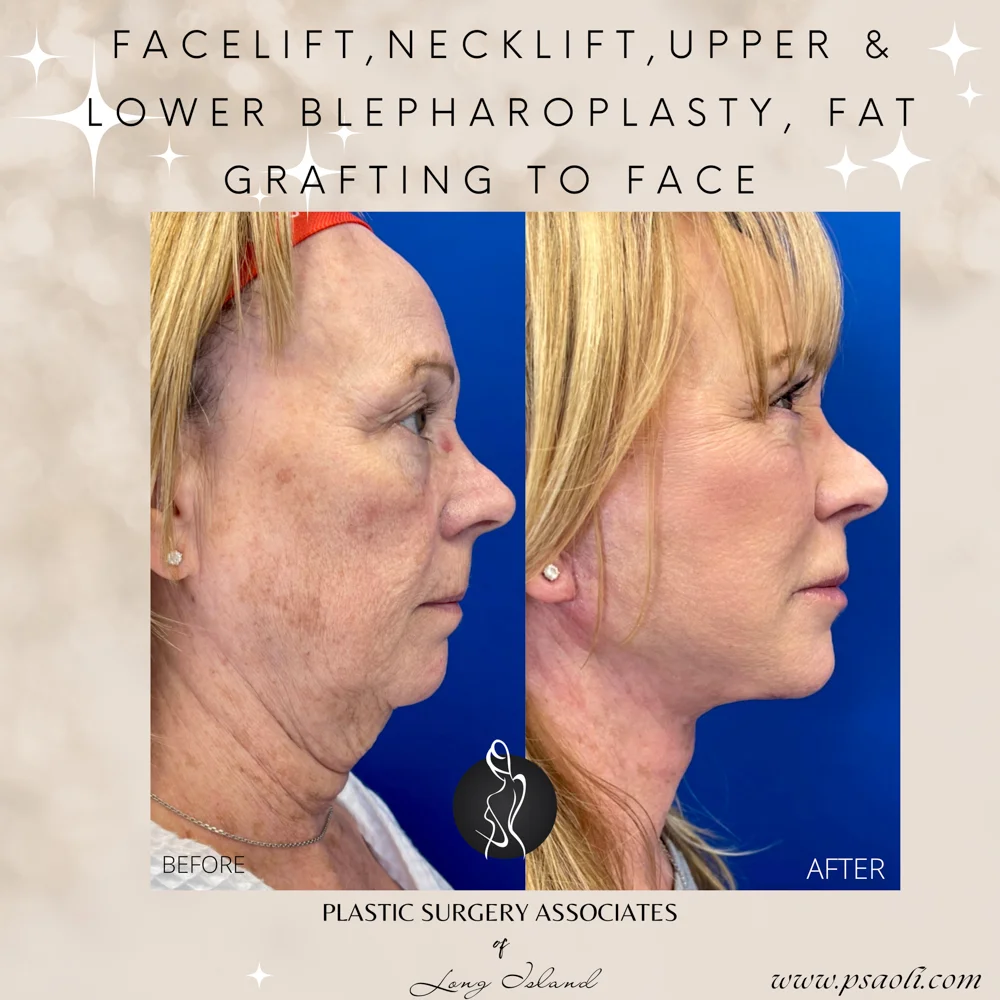 Neutral Delicate Magical Inspiring Reminder Animated Quote Instagram Post – 5