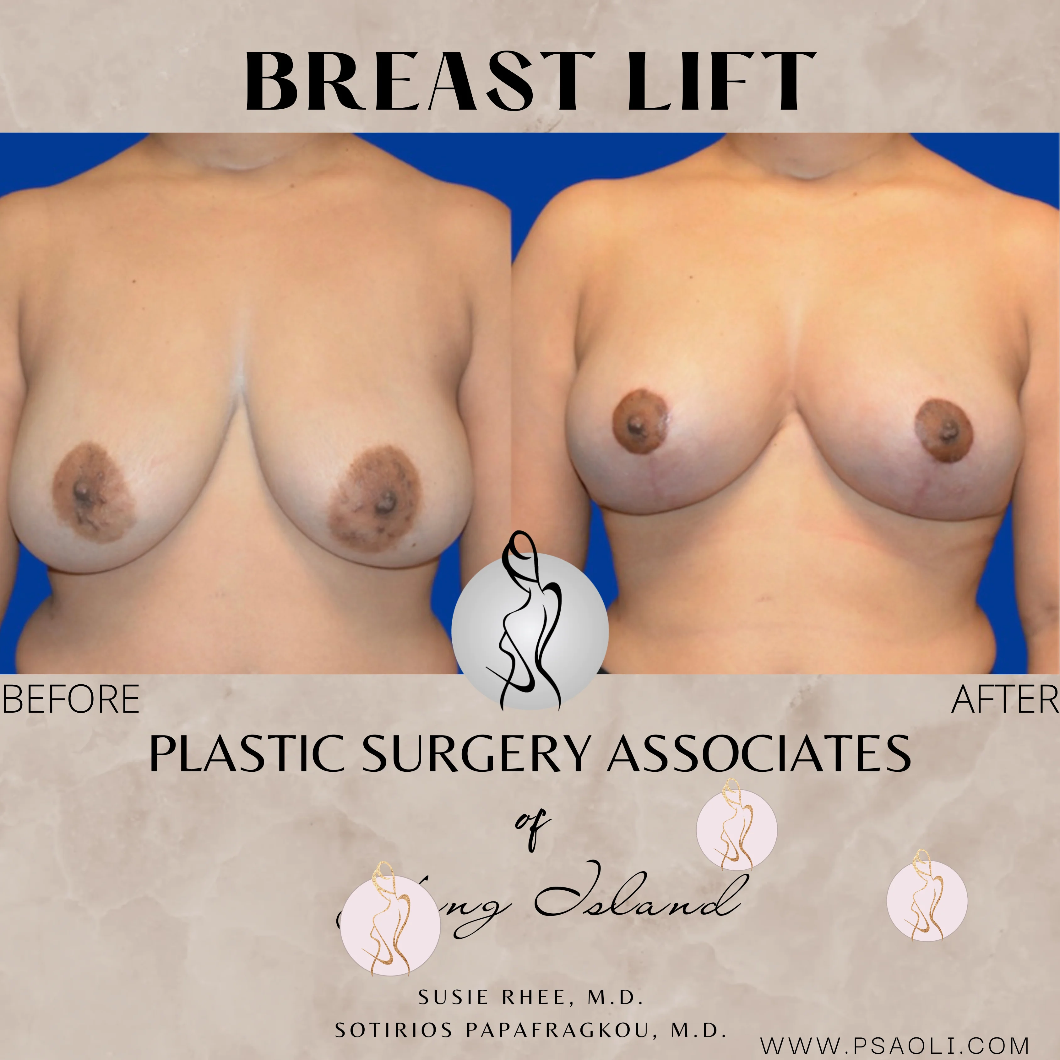 Neutral Minimalist Simple Elegant Marble Quote Instagram Post – 1