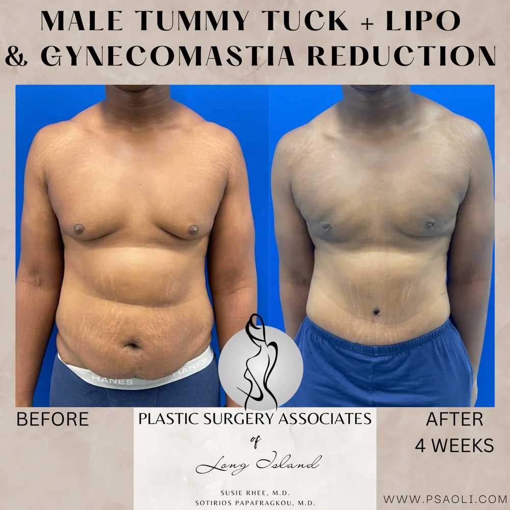 Neutral Minimalist Simple Elegant Marble Quote Instagram Post – 1