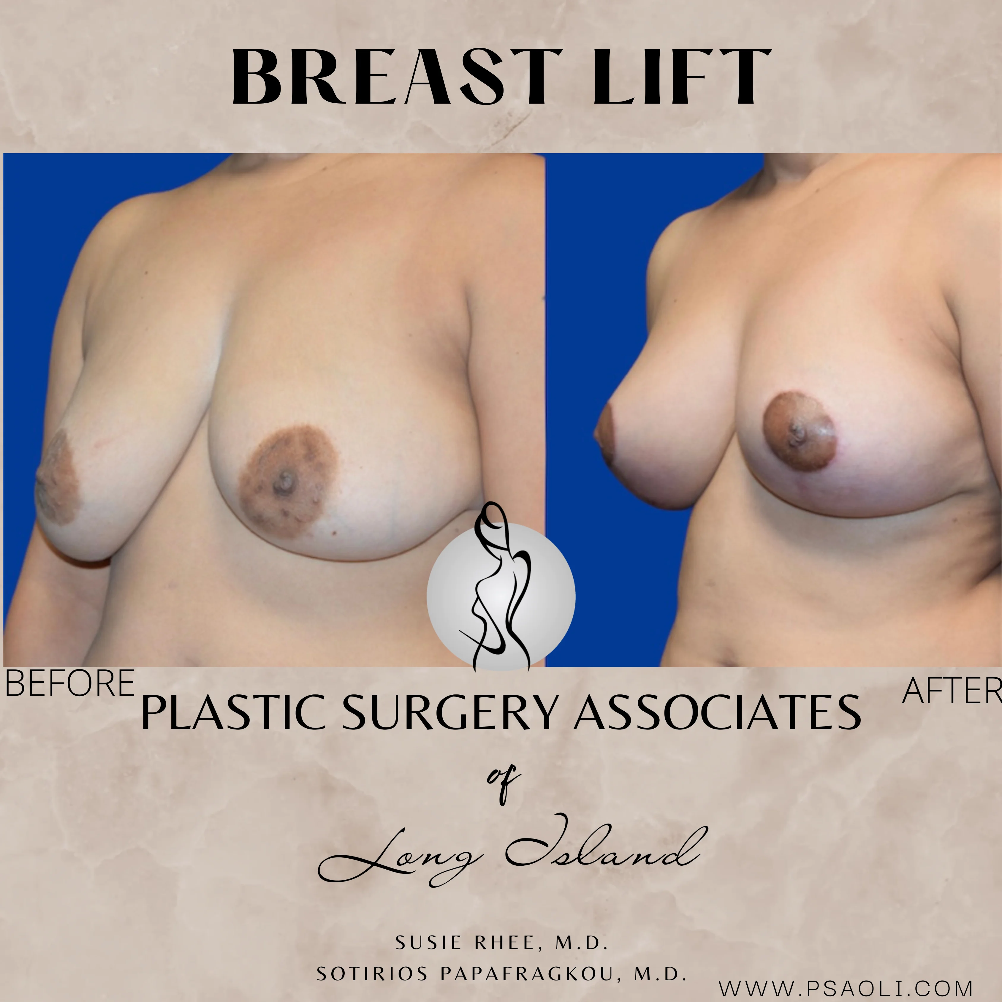 Neutral Minimalist Simple Elegant Marble Quote Instagram Post – 2