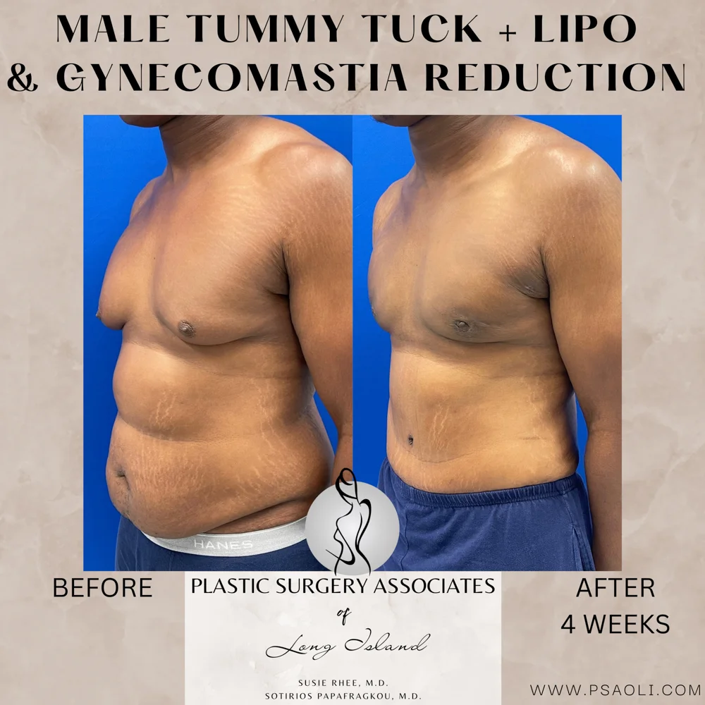 Neutral Minimalist Simple Elegant Marble Quote Instagram Post – 2