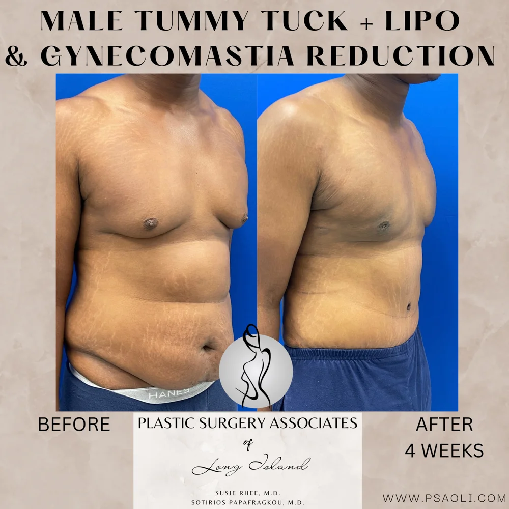 Neutral Minimalist Simple Elegant Marble Quote Instagram Post – 3