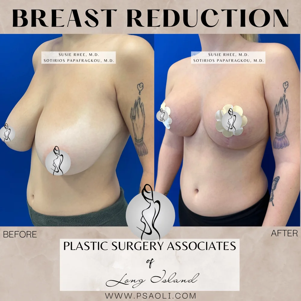 Neutral Minimalist Simple Elegant Marble Quote Instagram Post – 4