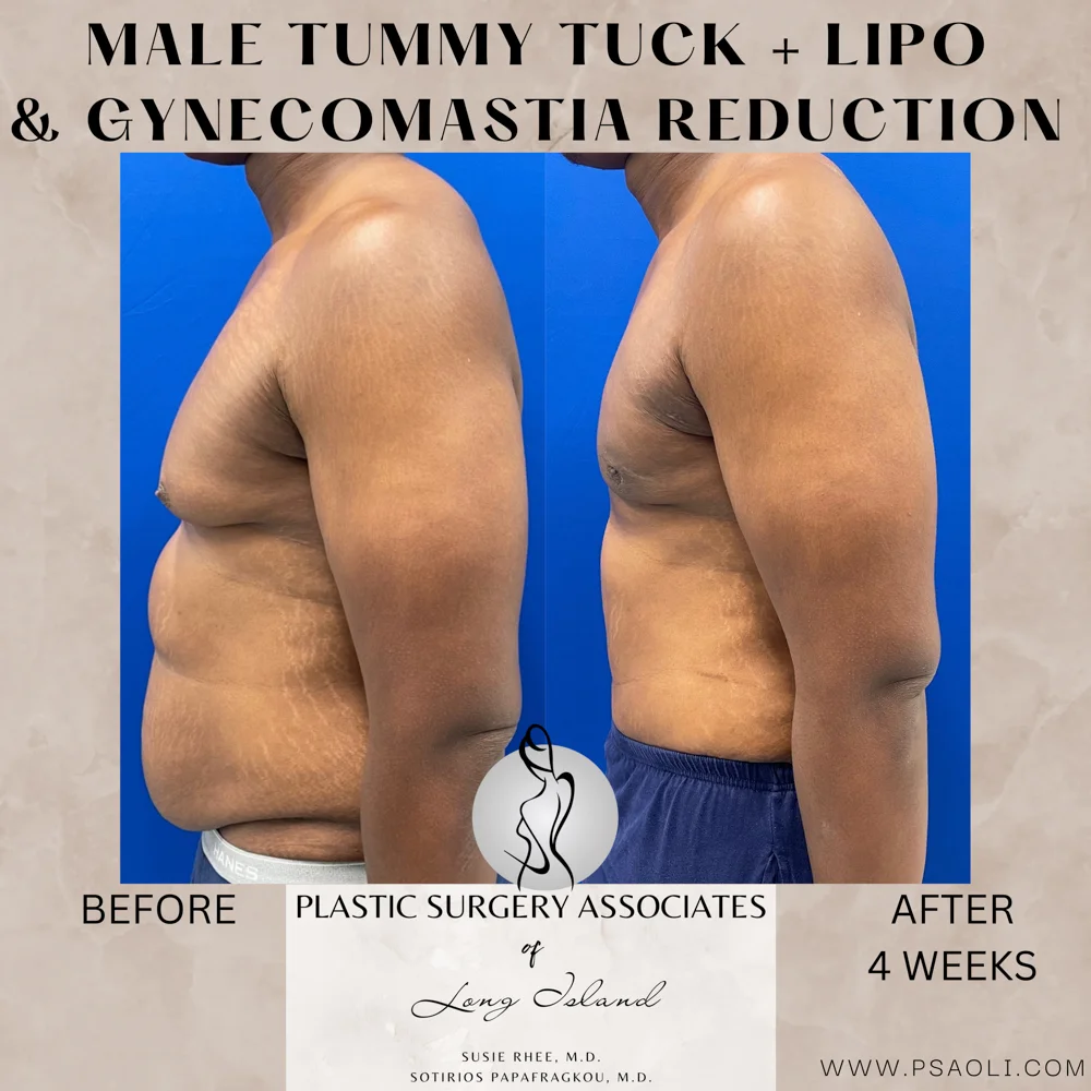 Neutral Minimalist Simple Elegant Marble Quote Instagram Post – 4