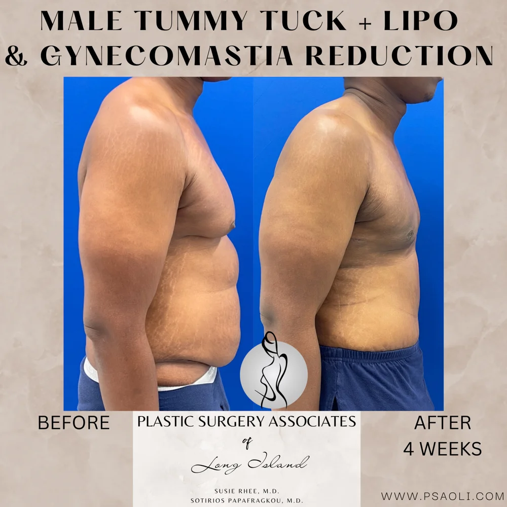 Neutral Minimalist Simple Elegant Marble Quote Instagram Post – 5