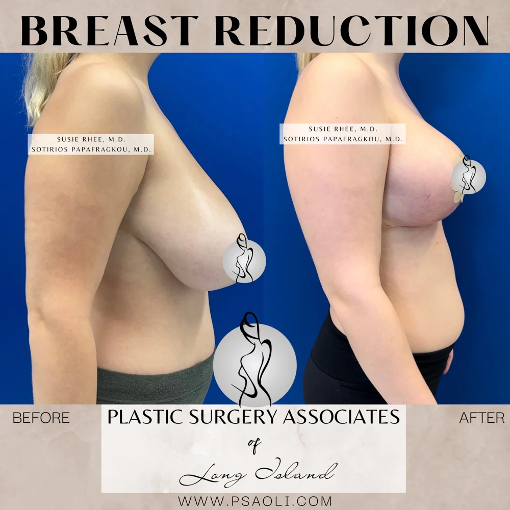 Neutral Minimalist Simple Elegant Marble Quote Instagram Post – 6