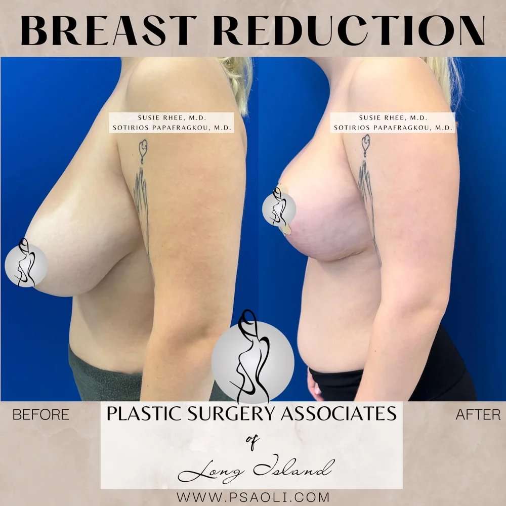 Neutral Minimalist Simple Elegant Marble Quote Instagram Post – 7