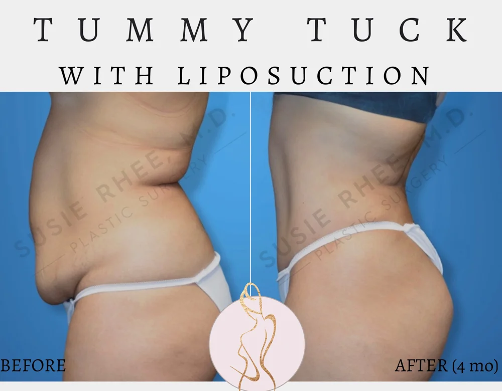 New Post Instagram Post