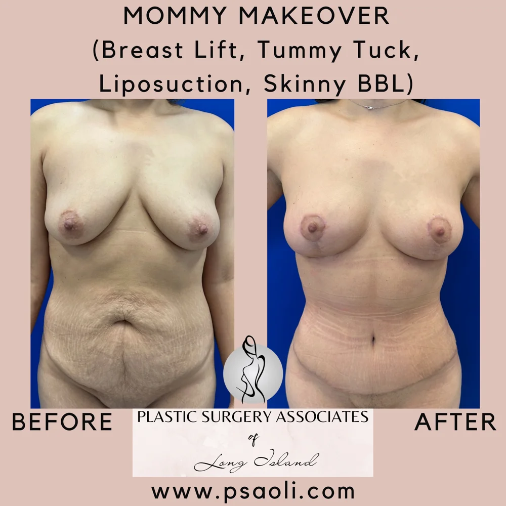 Pastel Pink Minimalist Quote Instagram Post – 1