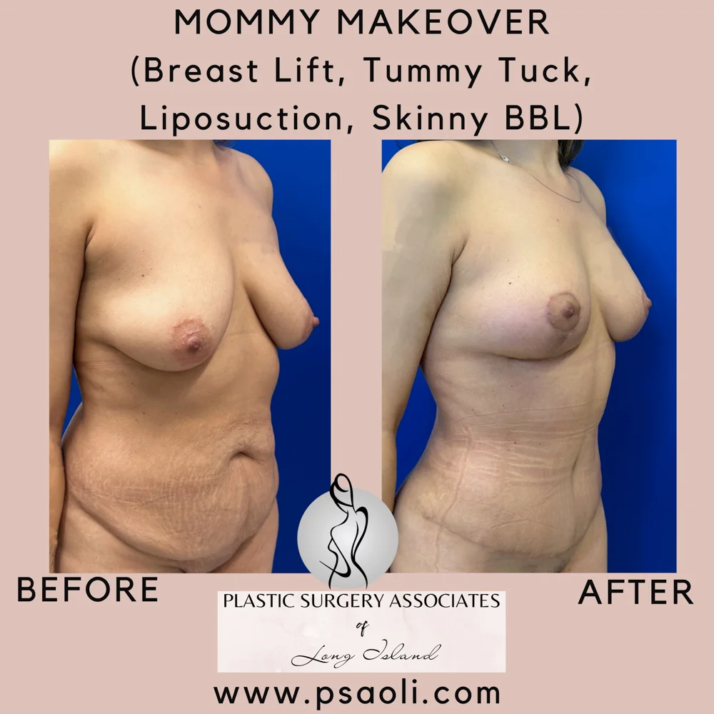 Pastel Pink Minimalist Quote Instagram Post – 2