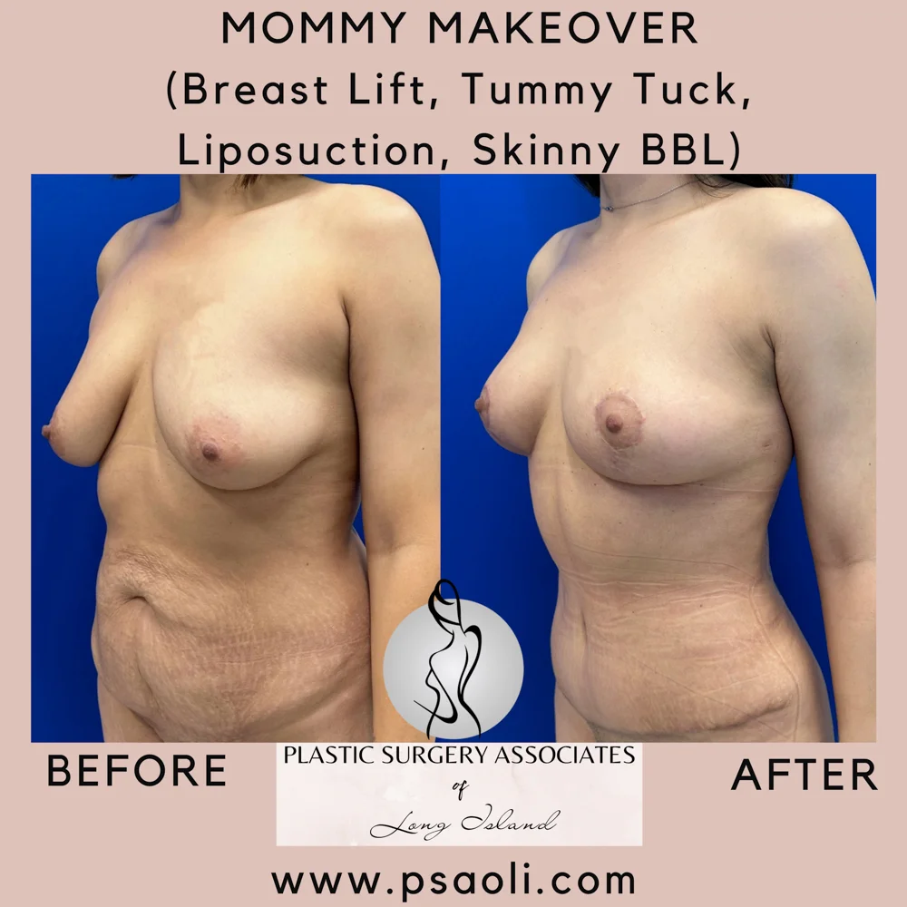 Pastel Pink Minimalist Quote Instagram Post – 3